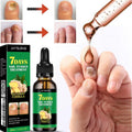 JAYSUING - 7 DAYS TRATAMIENTO PARA HONGOS EN UÑAS – PIES Y MANOS (30 ML)